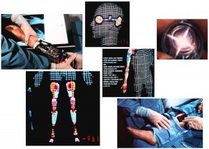 Six_Million_Dollar_Man_-_Opening_Sequence_-_Operation